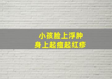 小孩脸上浮肿身上起痘起红疹