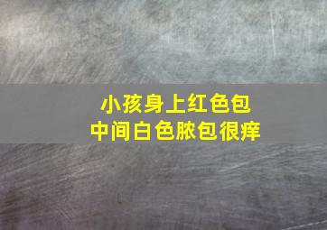 小孩身上红色包中间白色脓包很痒