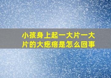 小孩身上起一大片一大片的大疙瘩是怎么回事