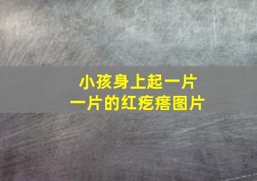 小孩身上起一片一片的红疙瘩图片