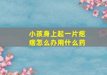 小孩身上起一片疙瘩怎么办用什么药