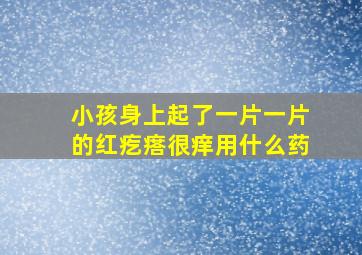 小孩身上起了一片一片的红疙瘩很痒用什么药