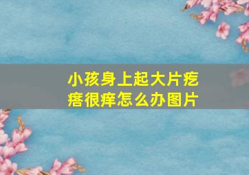 小孩身上起大片疙瘩很痒怎么办图片