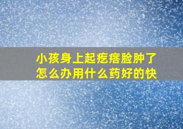 小孩身上起疙瘩脸肿了怎么办用什么药好的快