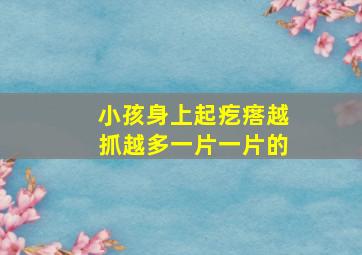 小孩身上起疙瘩越抓越多一片一片的