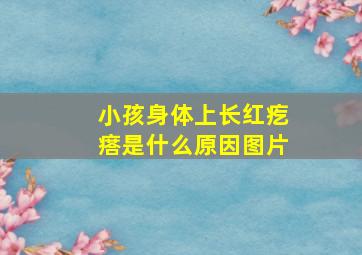 小孩身体上长红疙瘩是什么原因图片