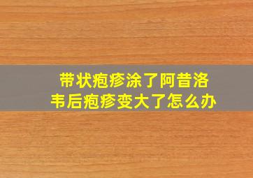 带状疱疹涂了阿昔洛韦后疱疹变大了怎么办