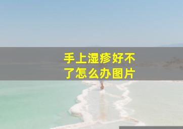 手上湿疹好不了怎么办图片