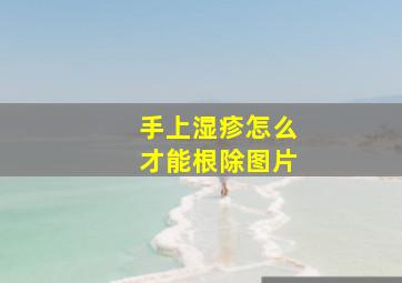 手上湿疹怎么才能根除图片