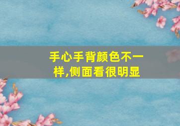 手心手背颜色不一样,侧面看很明显