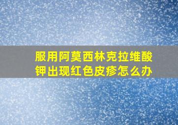 服用阿莫西林克拉维酸钾出现红色皮疹怎么办