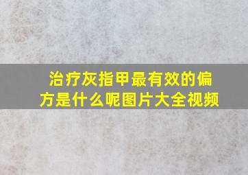 治疗灰指甲最有效的偏方是什么呢图片大全视频