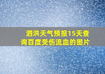 泗洪天气预报15天查询百度受伤流血的图片