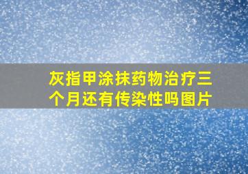 灰指甲涂抹药物治疗三个月还有传染性吗图片