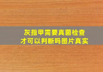 灰指甲需要真菌检查才可以判断吗图片真实