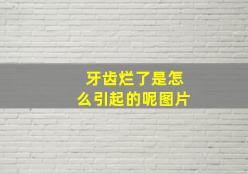 牙齿烂了是怎么引起的呢图片