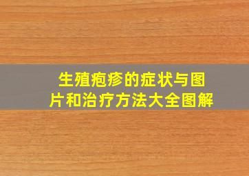 生殖疱疹的症状与图片和治疗方法大全图解