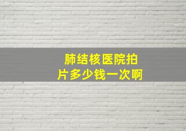 肺结核医院拍片多少钱一次啊