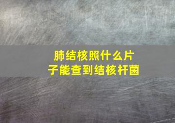 肺结核照什么片子能查到结核杆菌