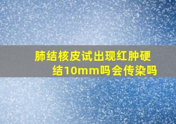 肺结核皮试出现红肿硬结10mm吗会传染吗