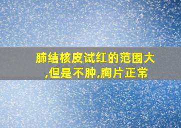 肺结核皮试红的范围大,但是不肿,胸片正常