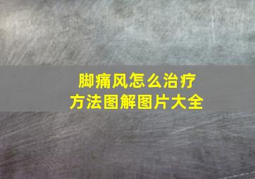 脚痛风怎么治疗方法图解图片大全