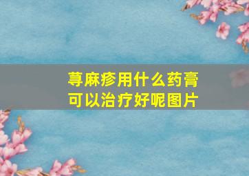 荨麻疹用什么药膏可以治疗好呢图片