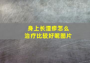 身上长湿疹怎么治疗比较好呢图片